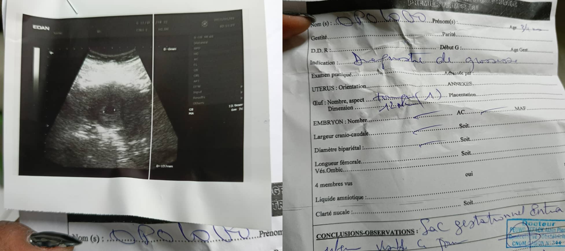 Après 15 ans, son miracle est arrivé : comment elle a retrouvé sa fertilité naturellement