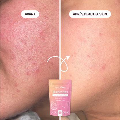Beautea skin - My secretea