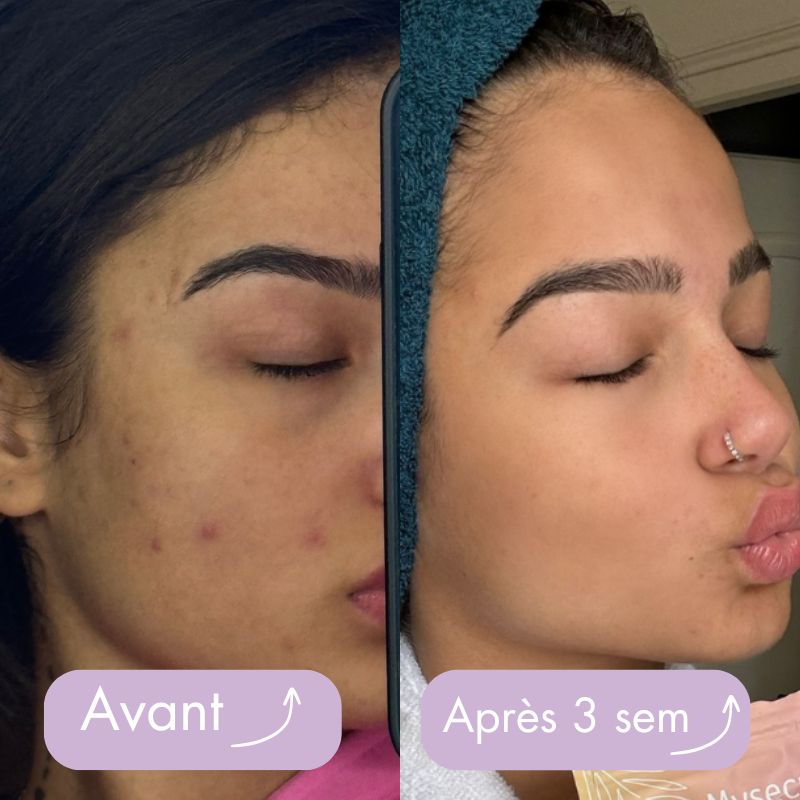 Box belle peau (Beautea Box)