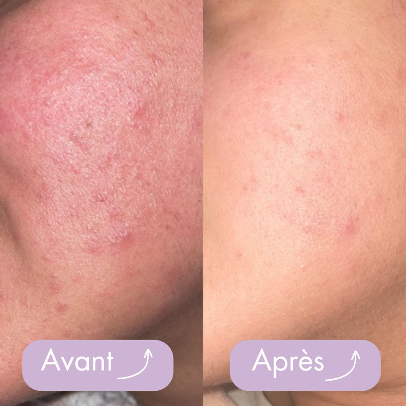 Box belle peau (Beautea Box)